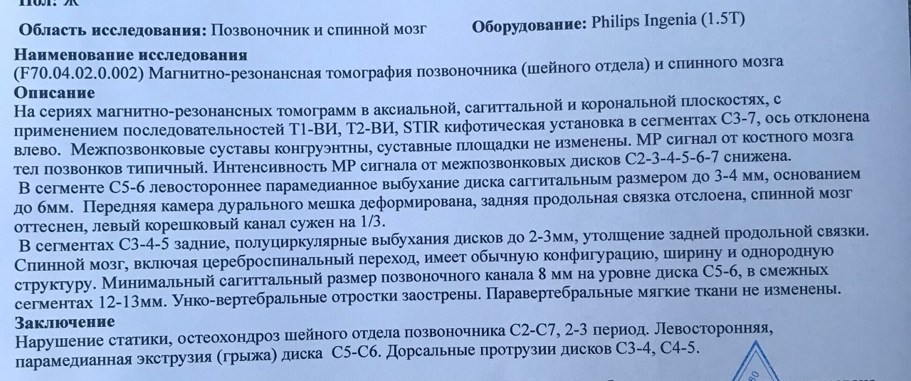 Вертеброгенная торакалгия мкб 10. Цервикобрахиалгия шейного отдела позвоночника. Вертеброгенная цервикобрахиалгия мкб. Цервикалгия шейного отдела позвоночника что это такое. Цервикалгия история болезни.