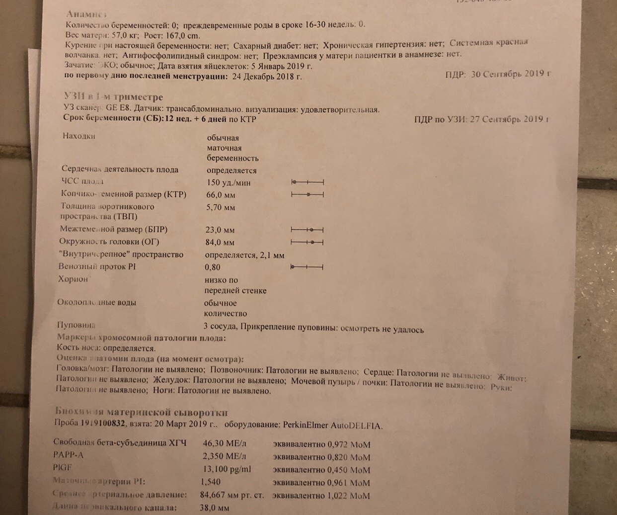 Задания 13 недели. Пи в венозном протоке 13 недель норма таблица. Венозный проток норма 1 скрининг. Пи в венозном протоке 13 недель норма. Венозный проток пи норма 13 недель.