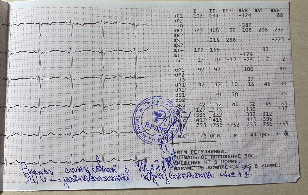 Экг ребенку 1 год