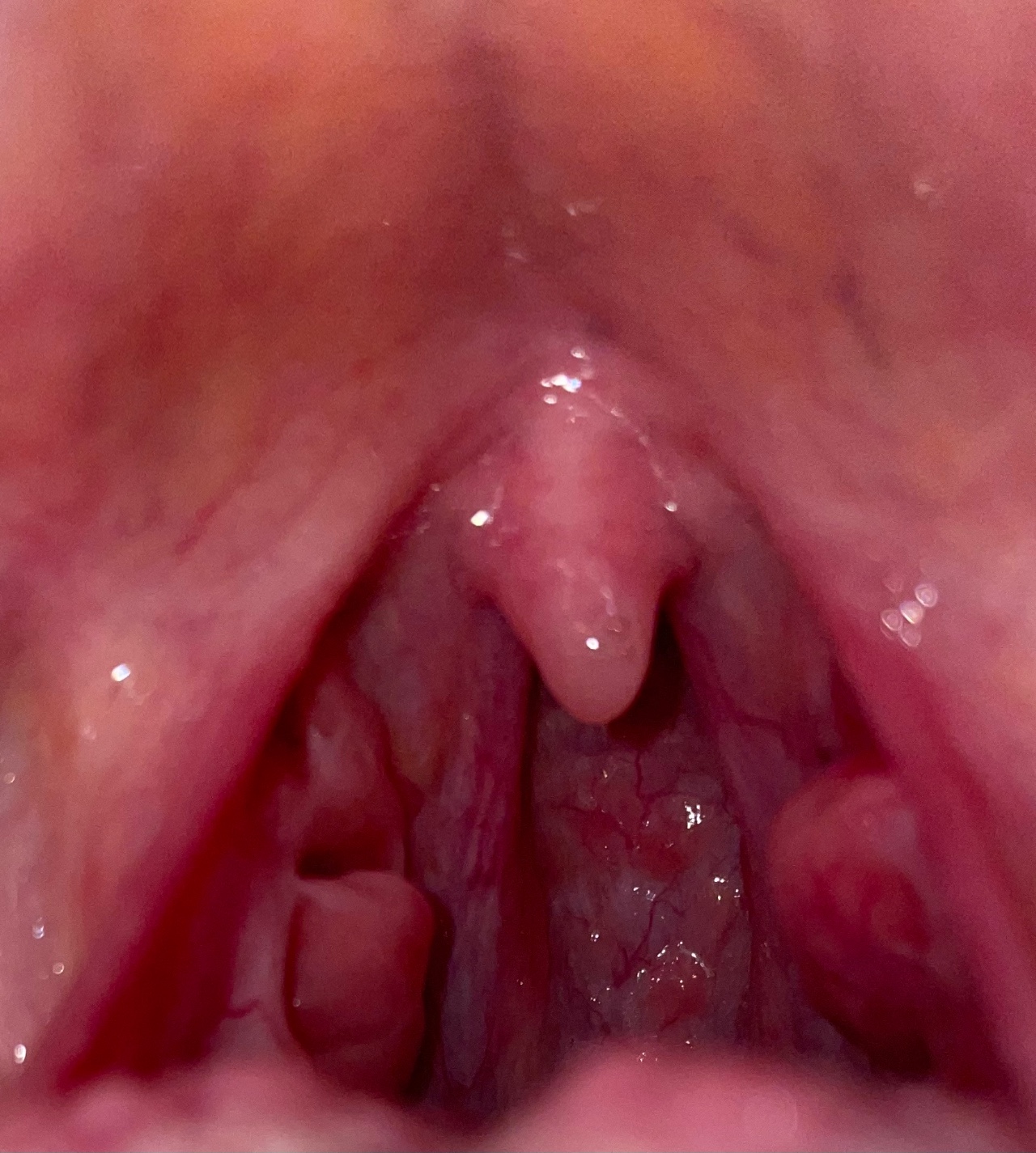можно ли вылечить горло спермой фото 43