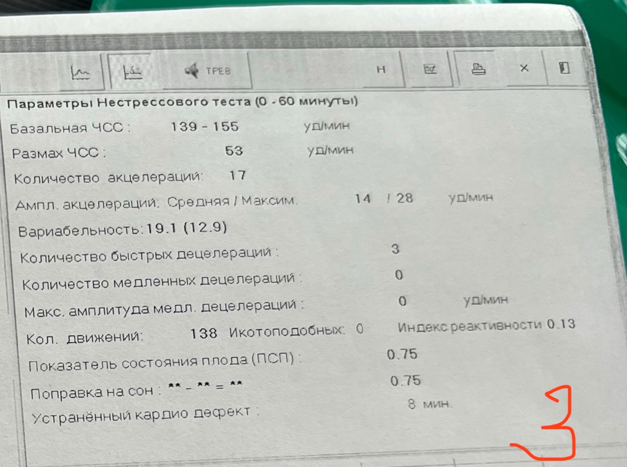 Нестрессовый тест. КТГ коэффициент технической готовности. КТГ П/2. КТГ П на 3. Алгоритм обработки датчиков КТГ.