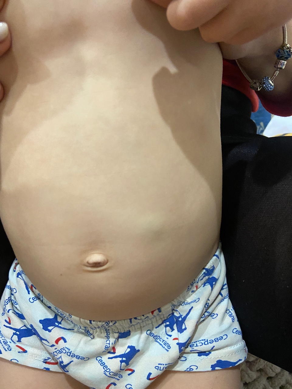 бугорки на груди во время беременности фото 46