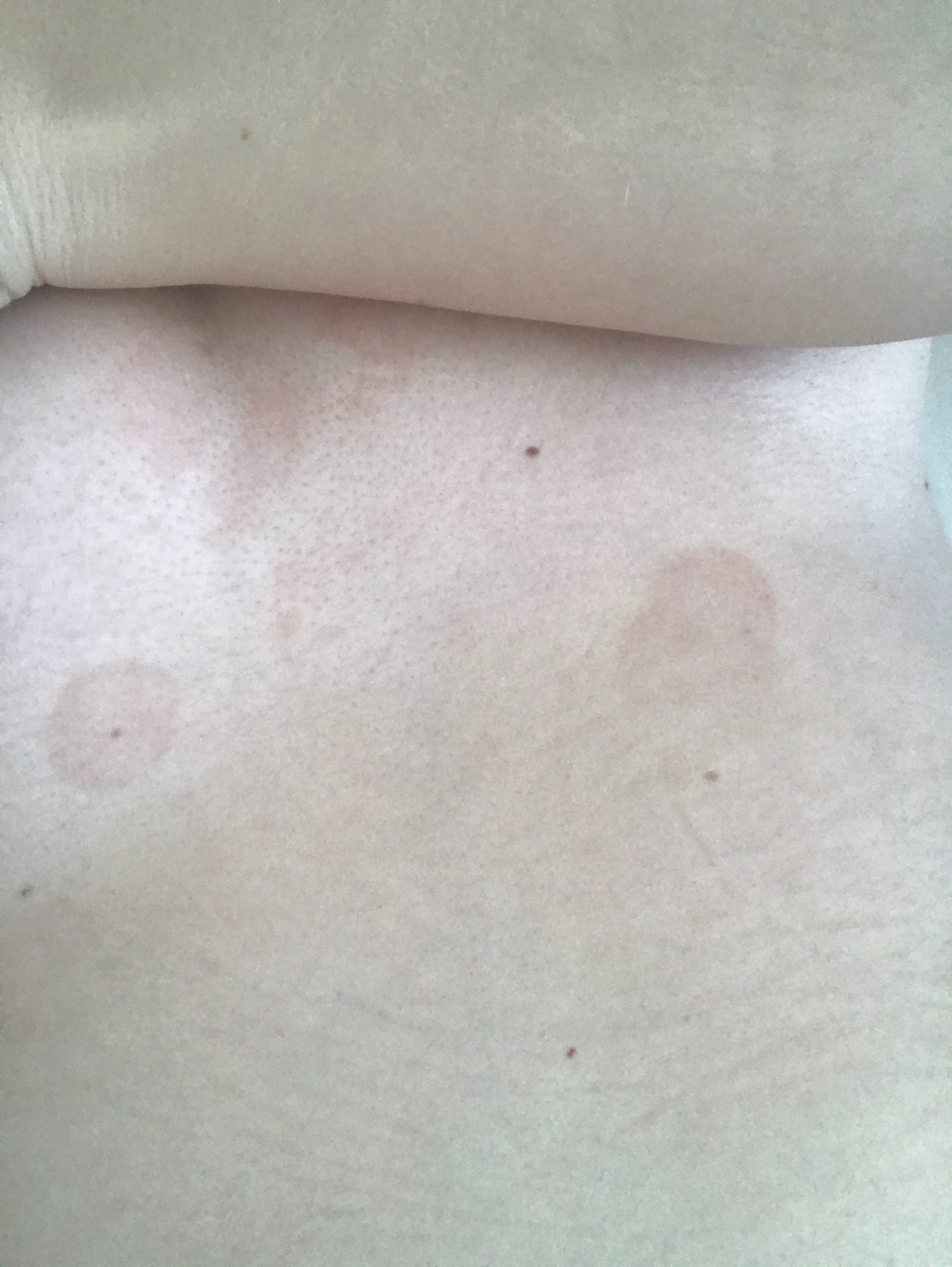 красные точки на груди у женщин фото 24