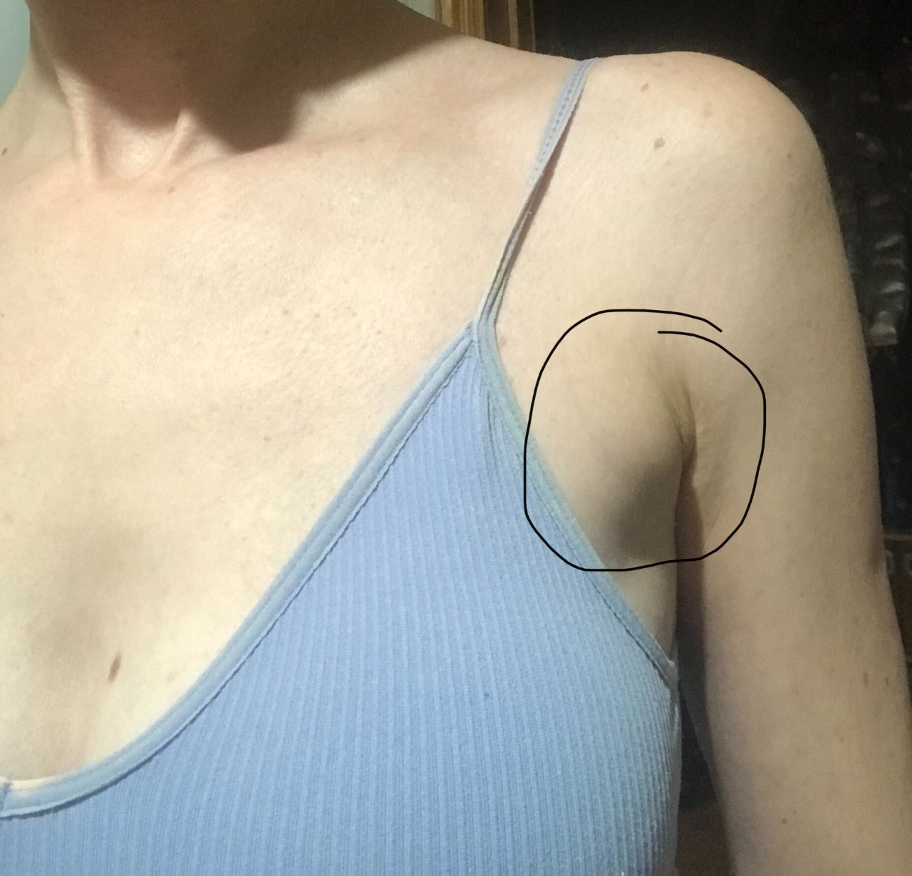 шишка на левой груди у женщин фото 74