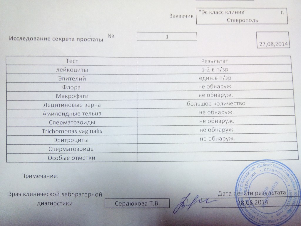 Большое количество секрета простаты