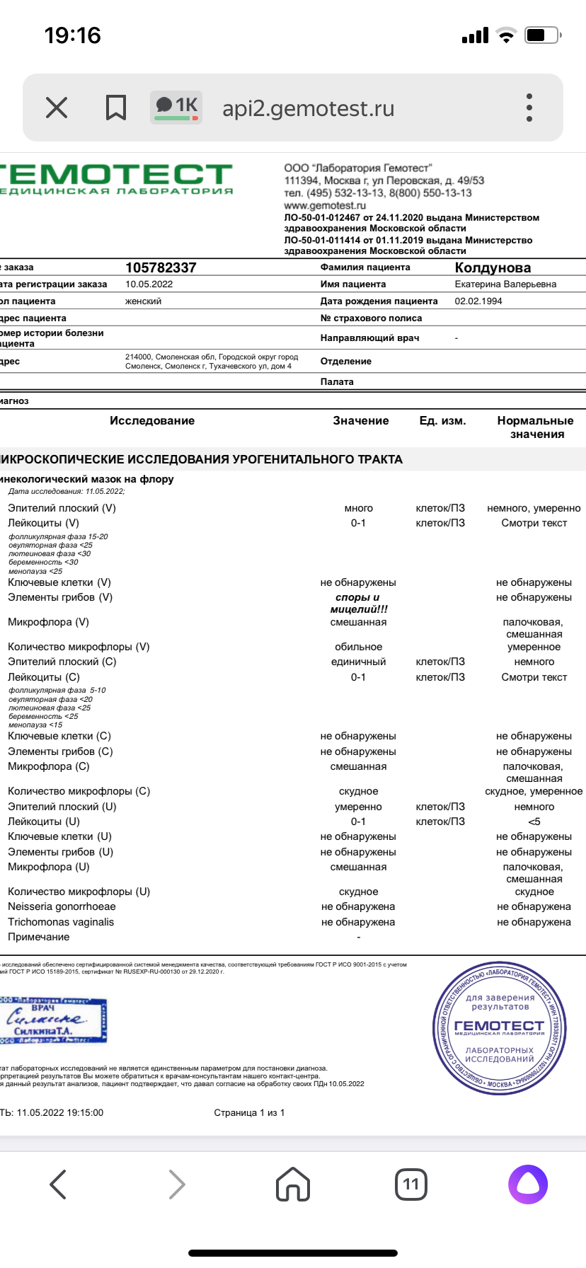 Грибковые инфекции мочевыводящих путей