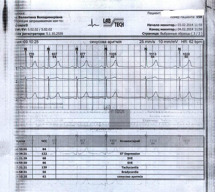 Тахизависимый интервал QT, консультация кардиолога онлайн - Вопрос ...