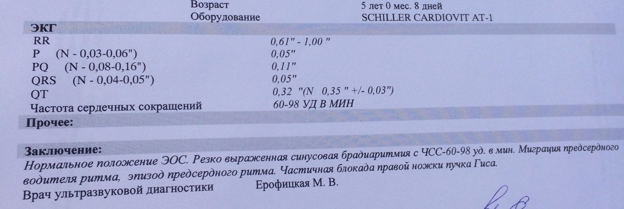 Недавно сделал экг своего сердца не поверил но взглянул на диаграмму и нашел там твое