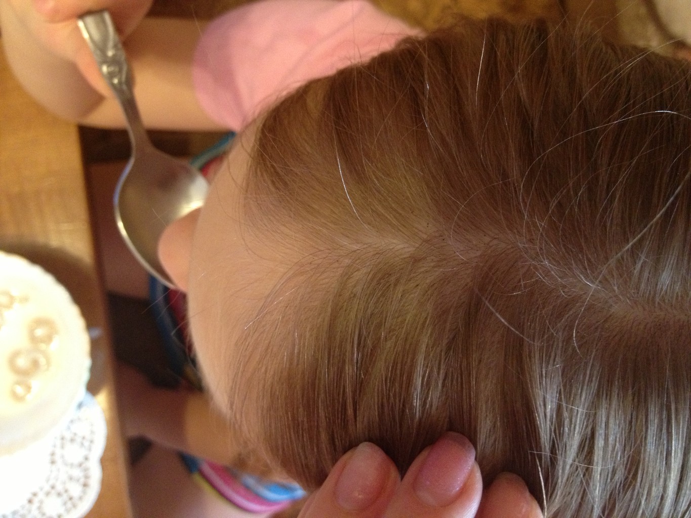 Что делать с катышками на волосах у ребенка