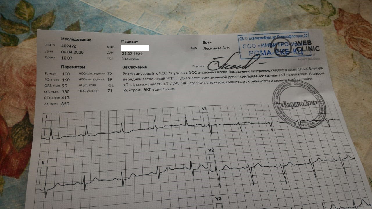 Сколько действительно экг. Результаты ЭКГ. Результат ЭКГ сколько. Результат ЭКГ возрастное. Результат ЭКГ 74 уд /мин.