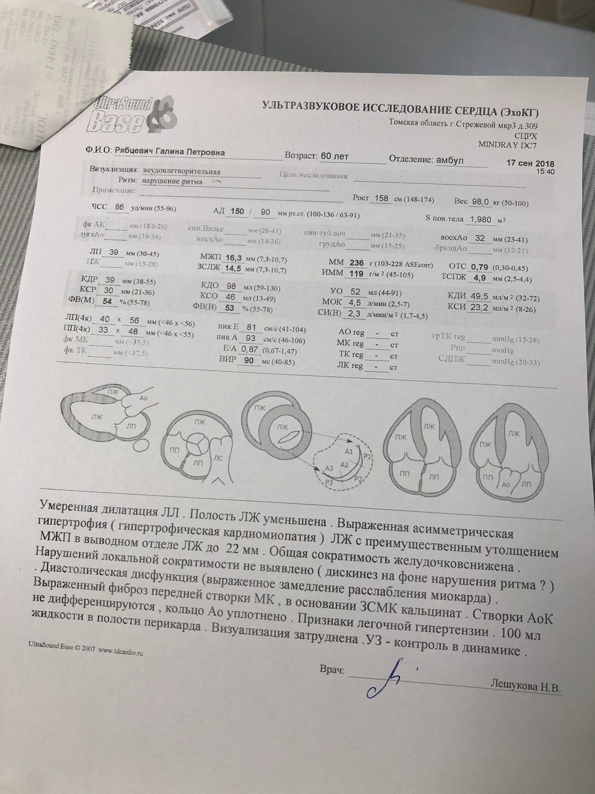 Расшифровка узи сердца у взрослого