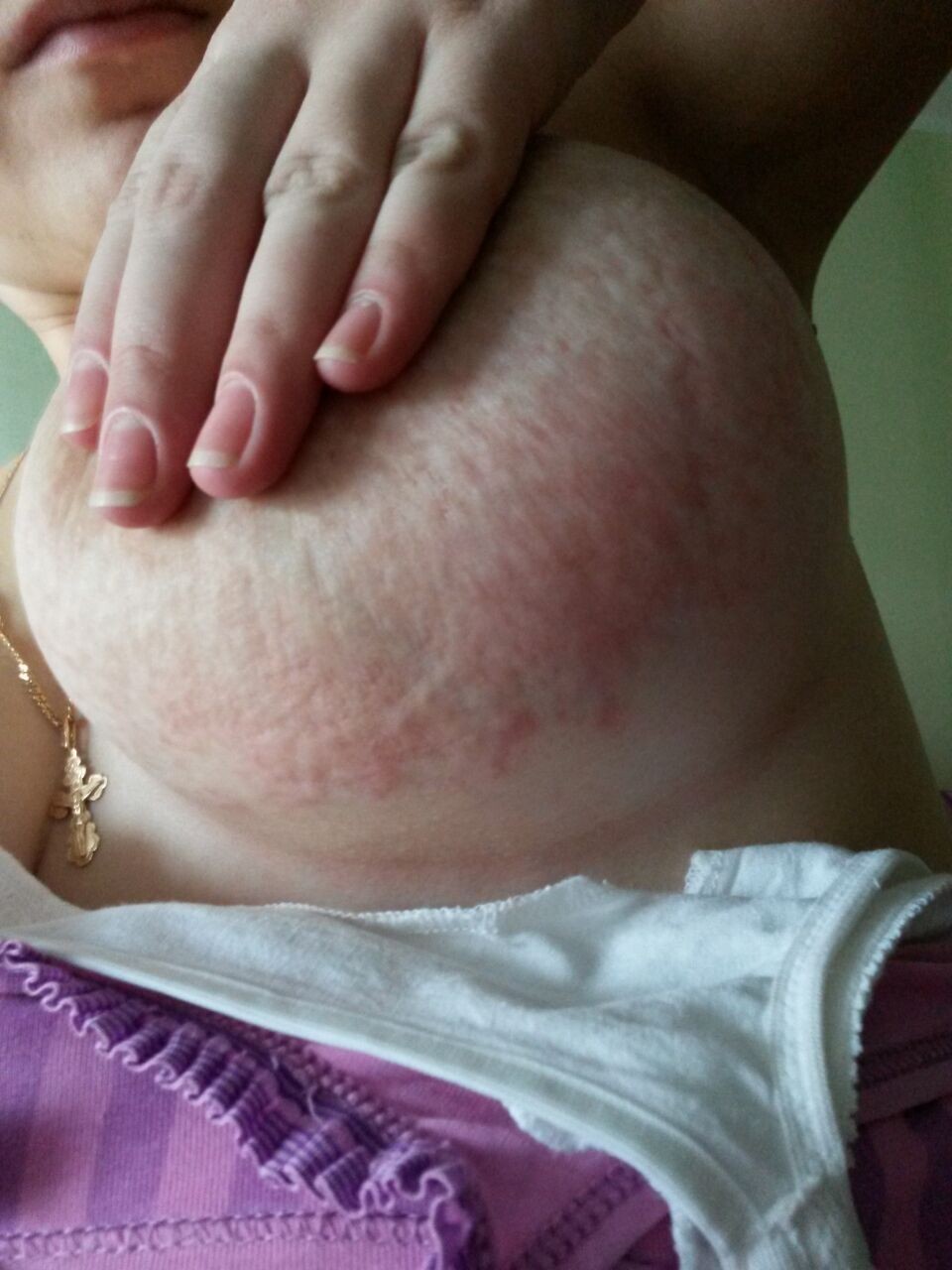 кожа груди чешется у женщин фото 27