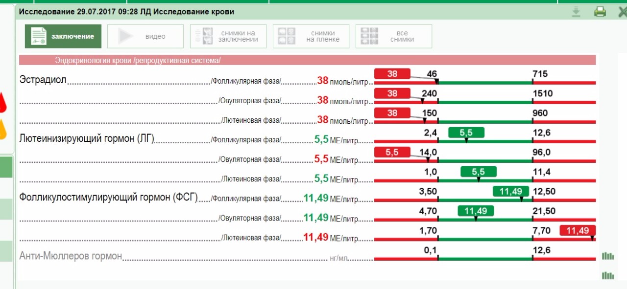 Анализ лг