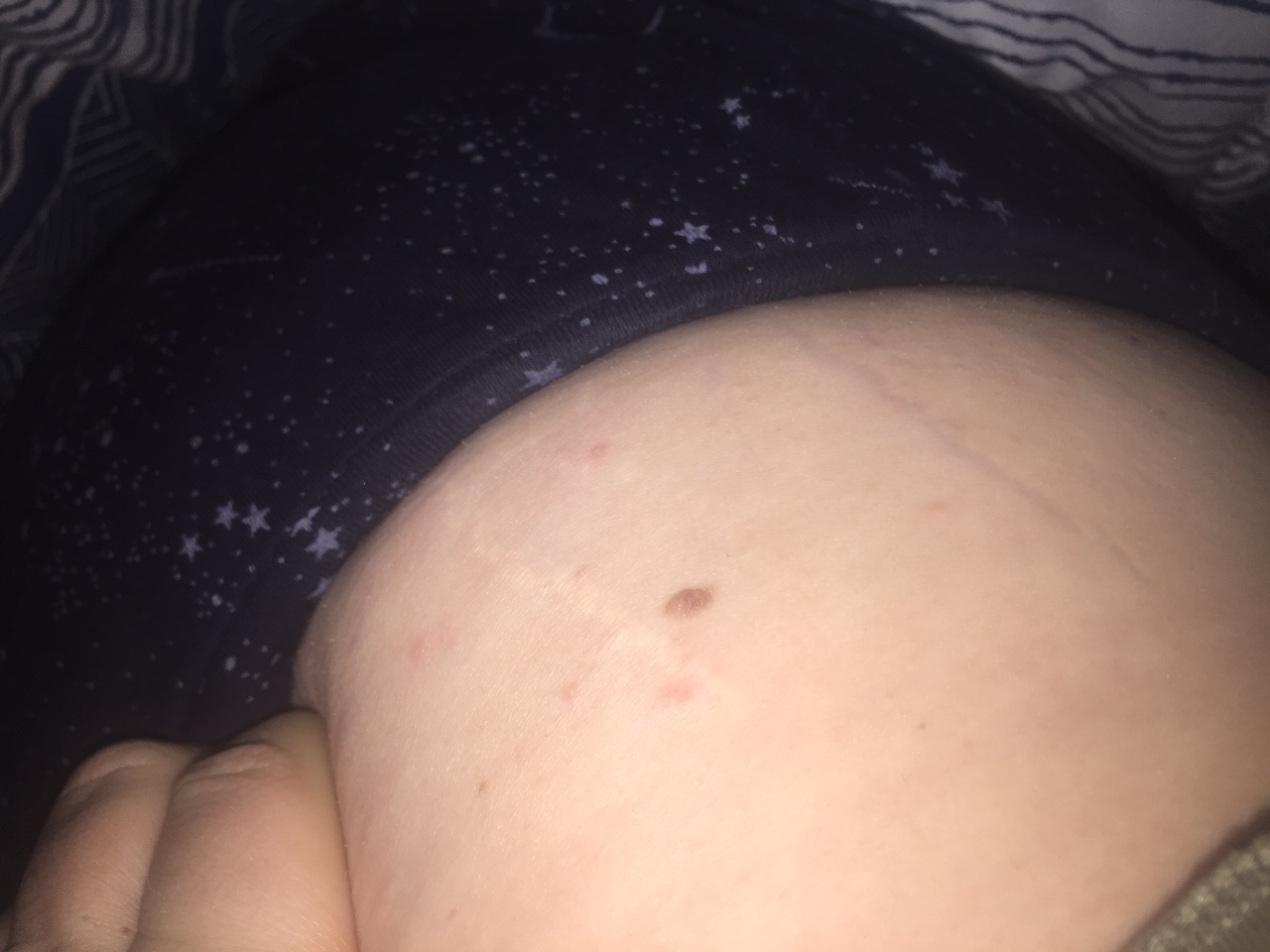 чешется левая грудь беременность фото 70