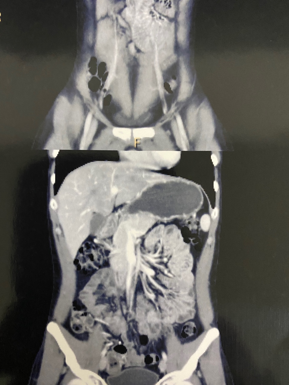 Кт печени гемангиома или что Вопрос рентгенологу 03 Онлайн