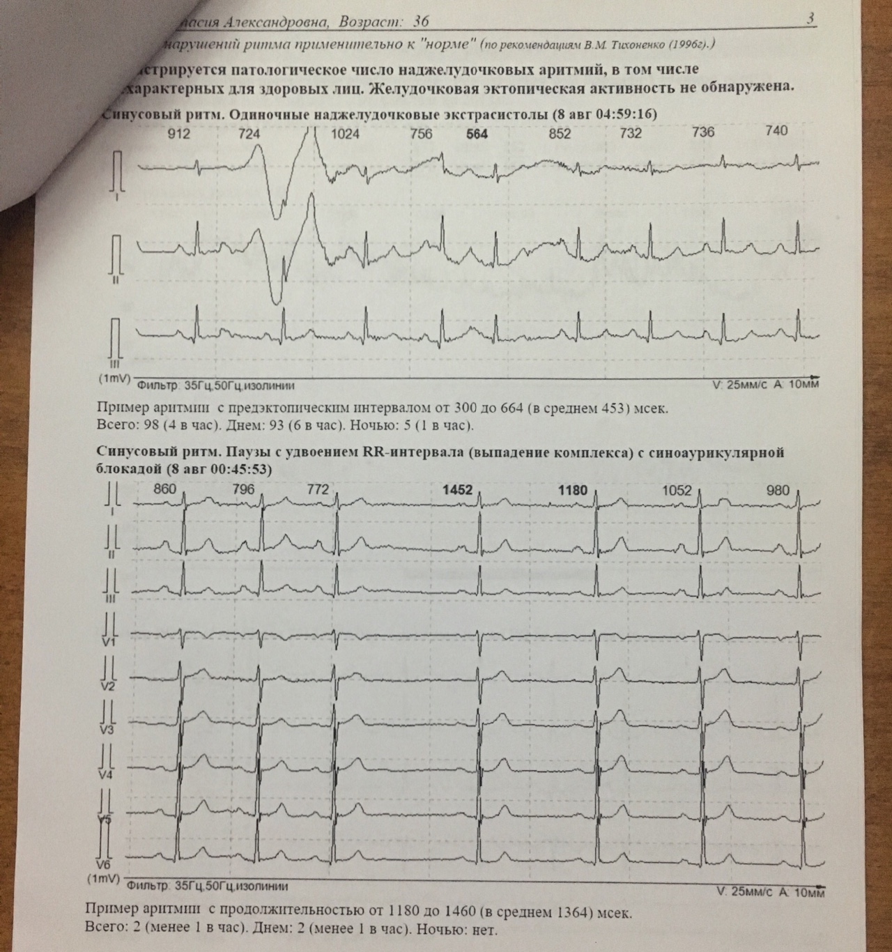 стенокардия напряжения дифференциальная диагностика. как отличить невралгию от сердечной боли. отличие невралгии от боли в сердце. как отличить сердечную боль от. боль в сердце.