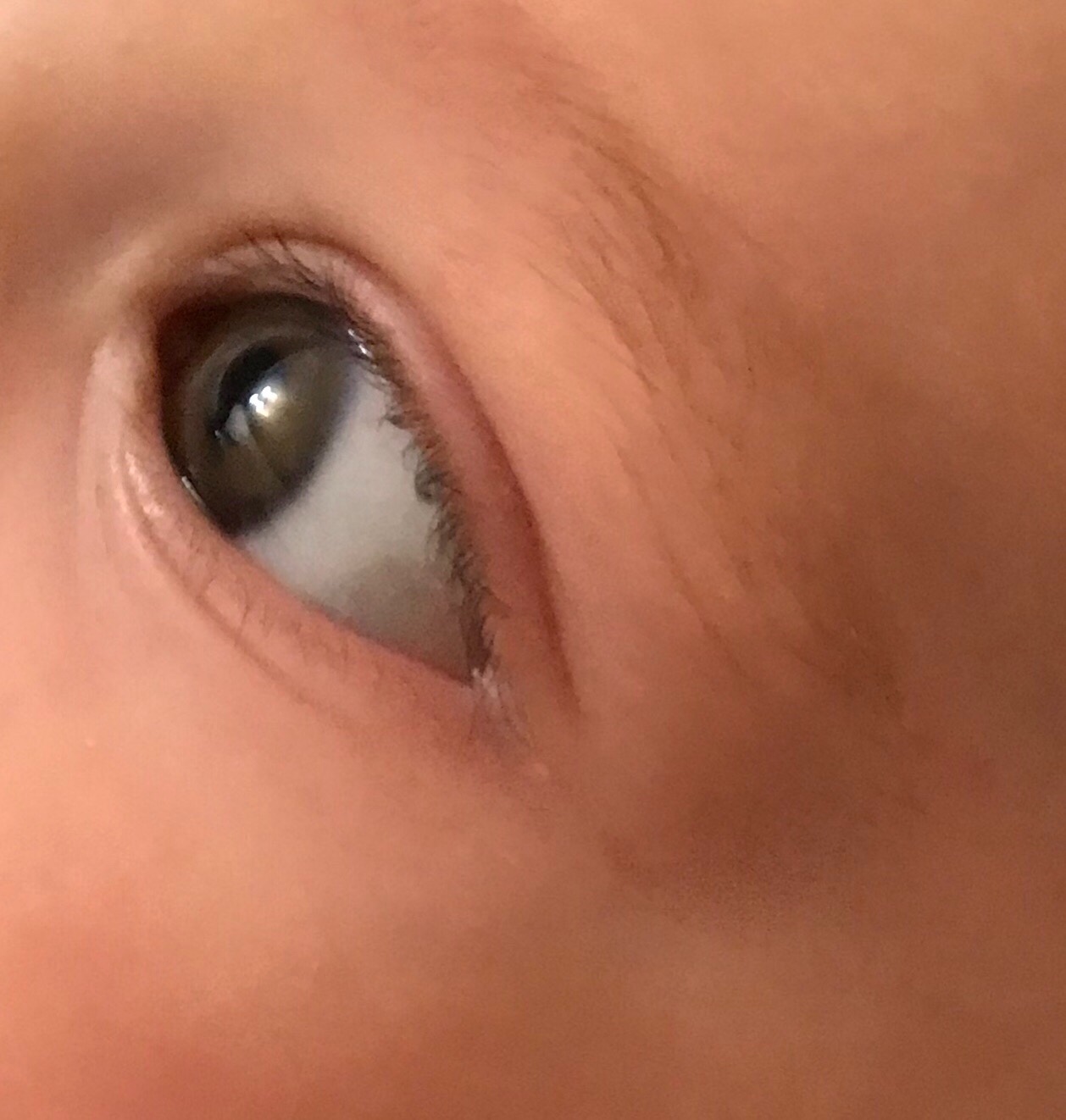 Тёмные белки глаз у младенца