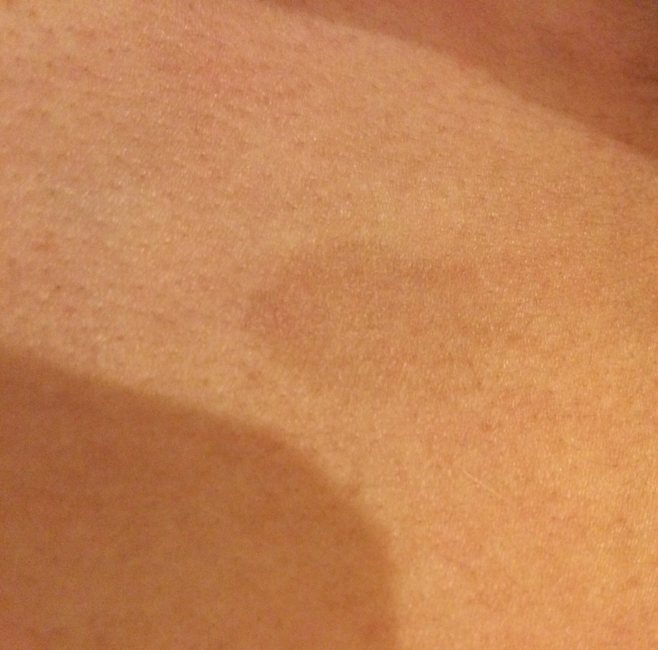 светло коричневые пятна на груди у женщин фото 12