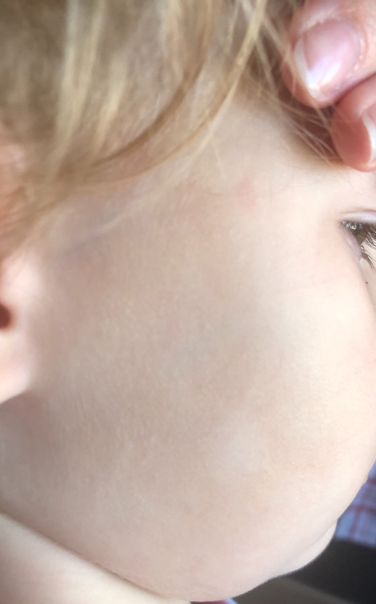 Белые пятнышки на лице у ребенка