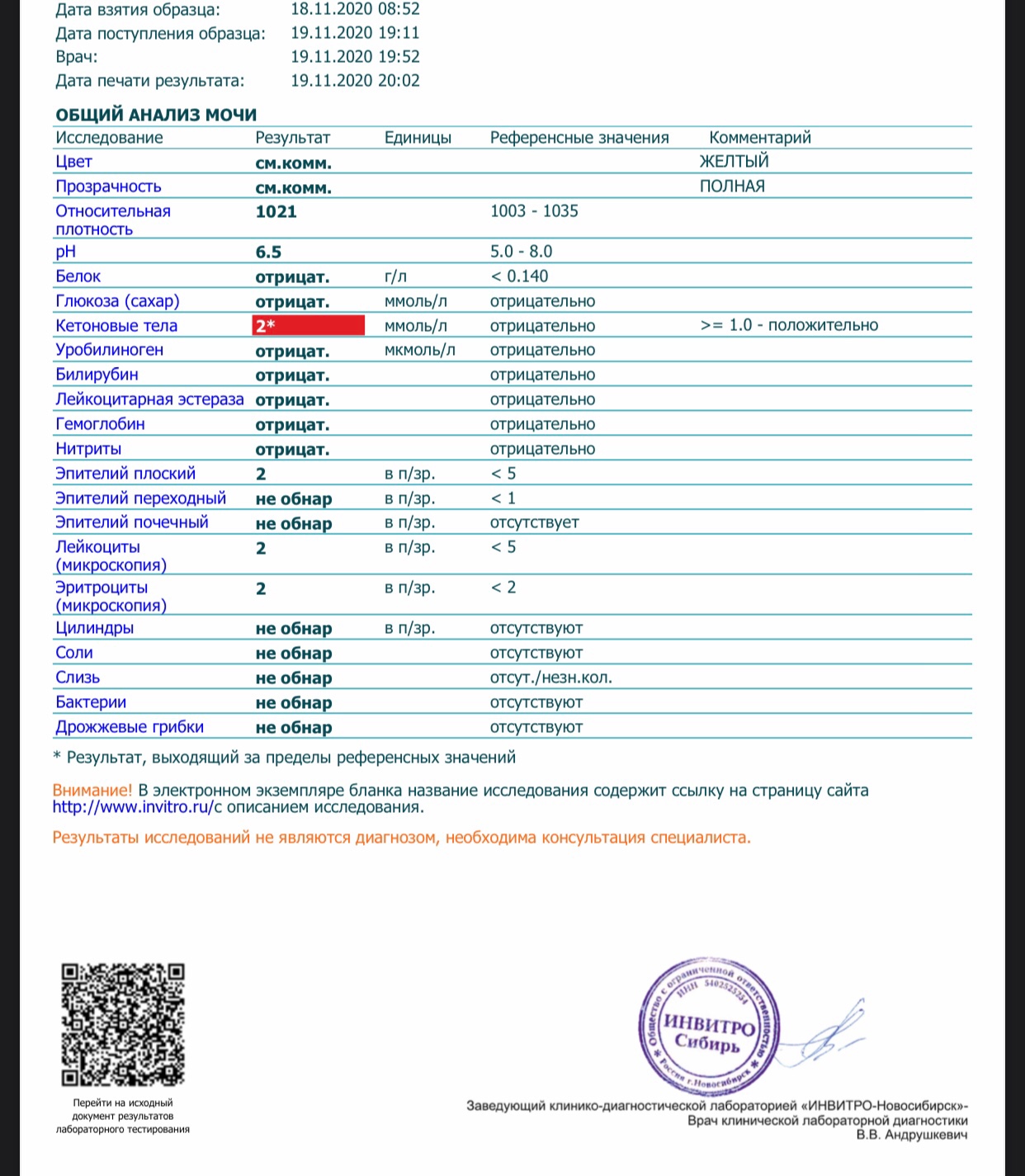 Кетоновые тела в моче что. Кетоны в моче 80 мг/дл. Анализ мочи кетоновые тела норма. Кетоновые тела в моче норма 1.0. Кетоновые тела в моче 1.5 в беременность.