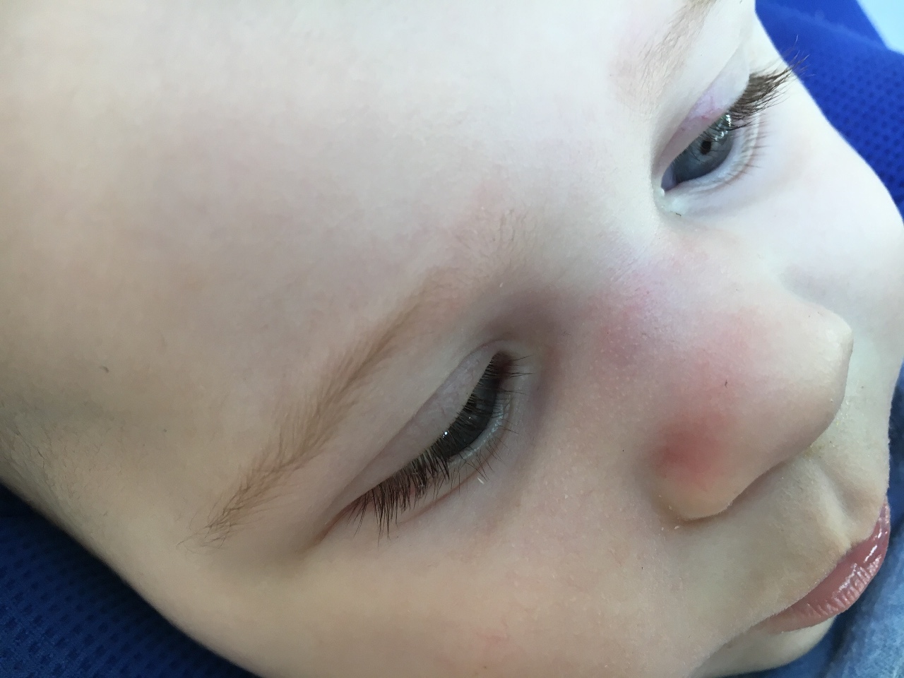 ребенок упал с кровати из носа кровь в 8 месяцев