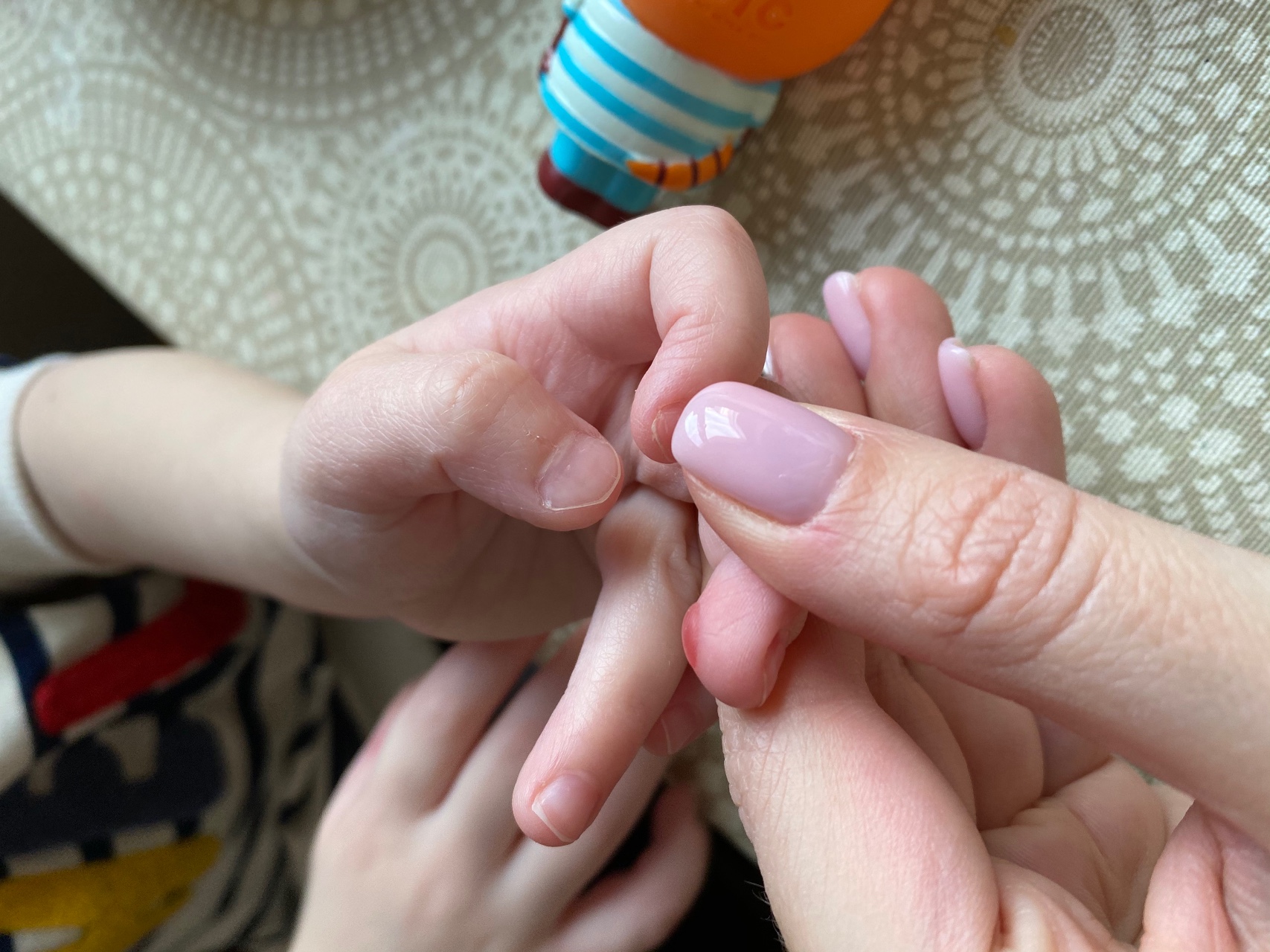 Волдыри на пальчиках у ребенка