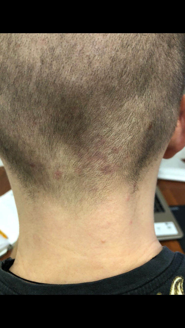 Последствия стрижки и бритья волос в августе