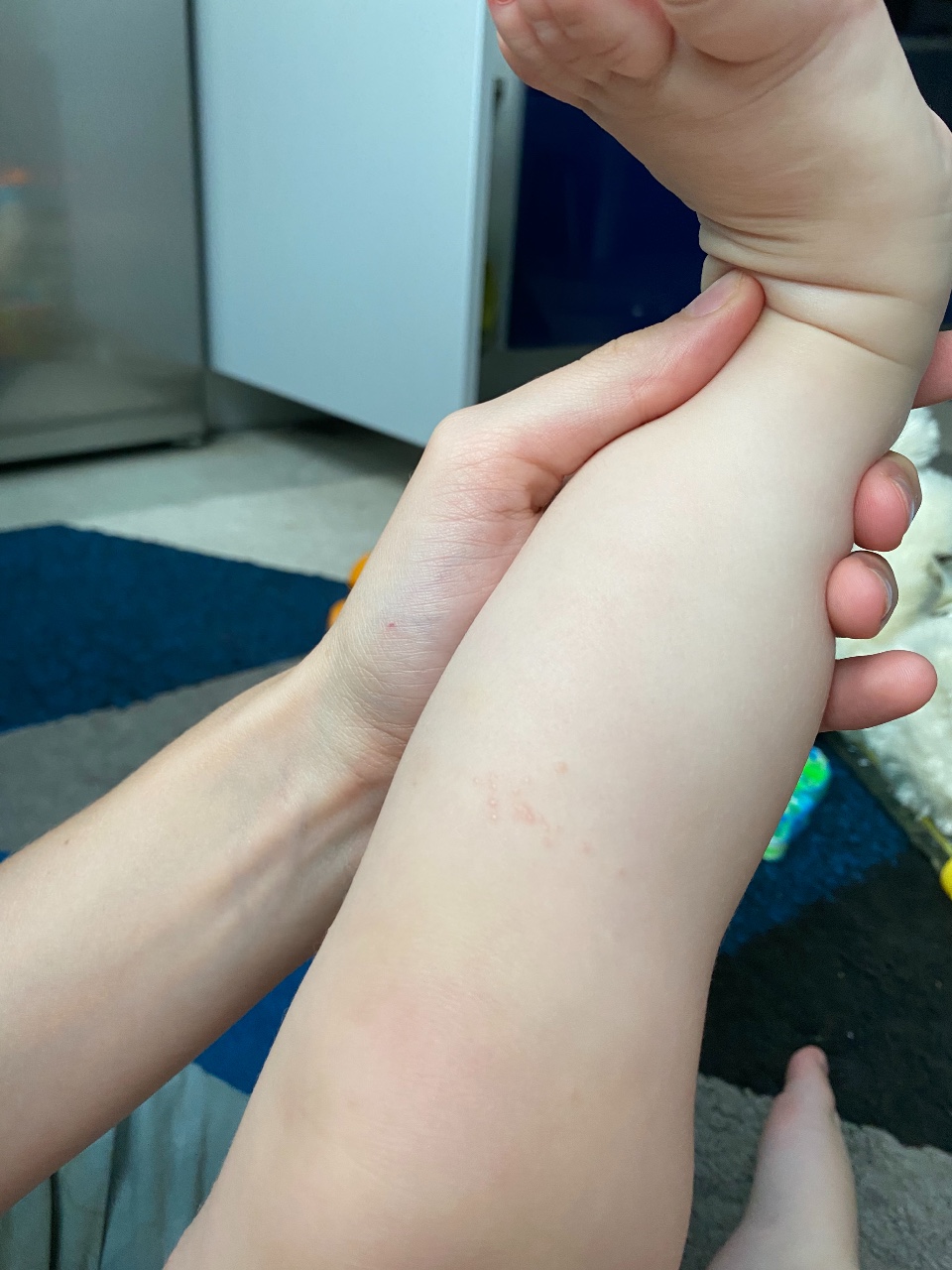 волосатые ноги у ребенка 6 лет фото 109