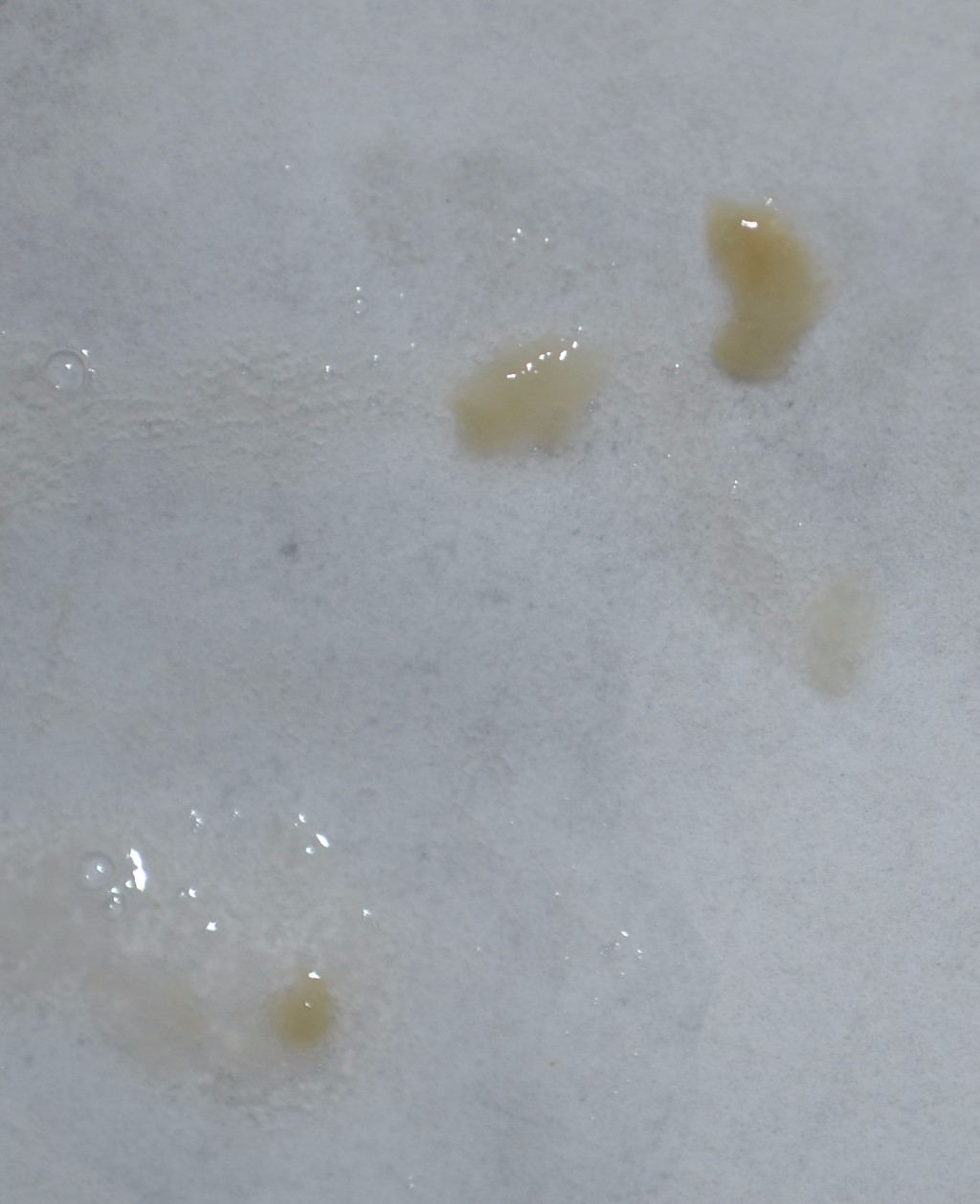 спермы с желтым оттенком фото 68