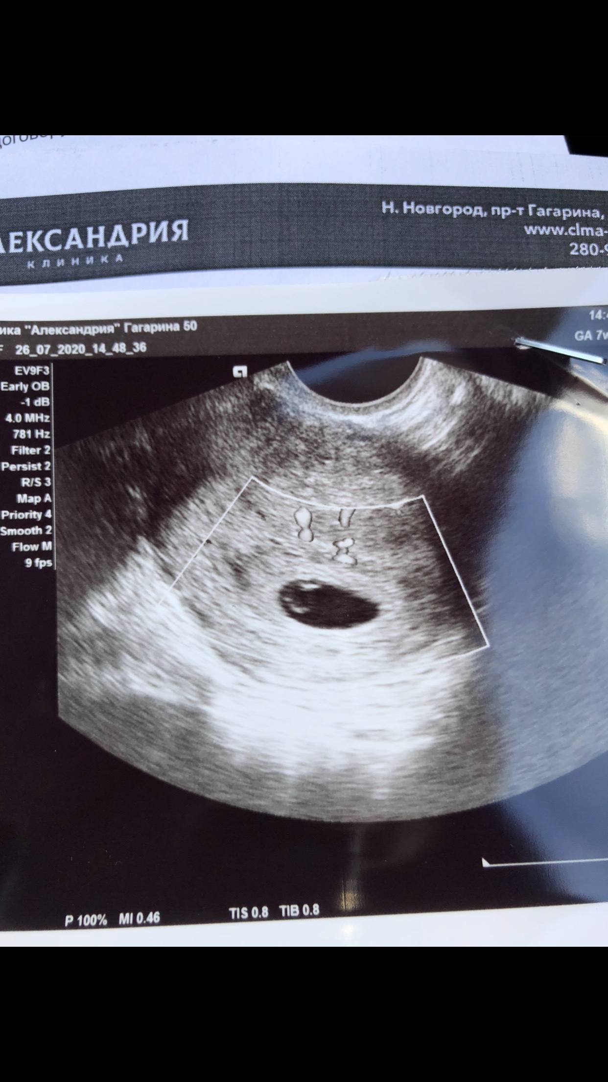 Эмбрион 5 Недель Фото
