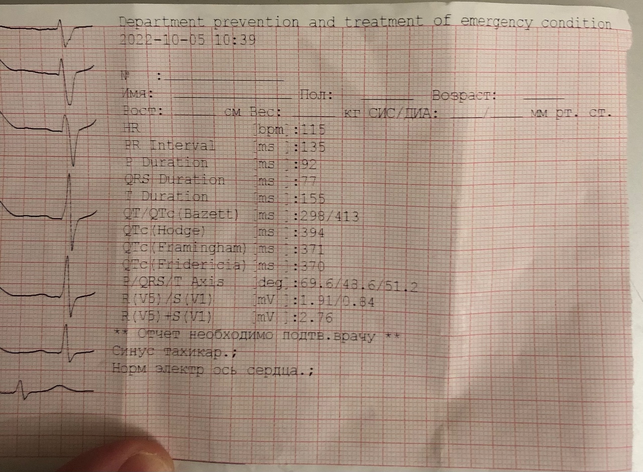 Экг при тахикардии фото