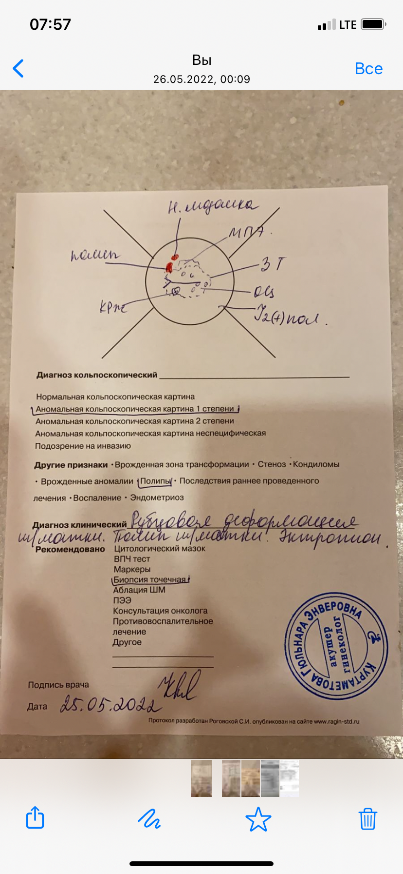 После полового акта начинается зуд