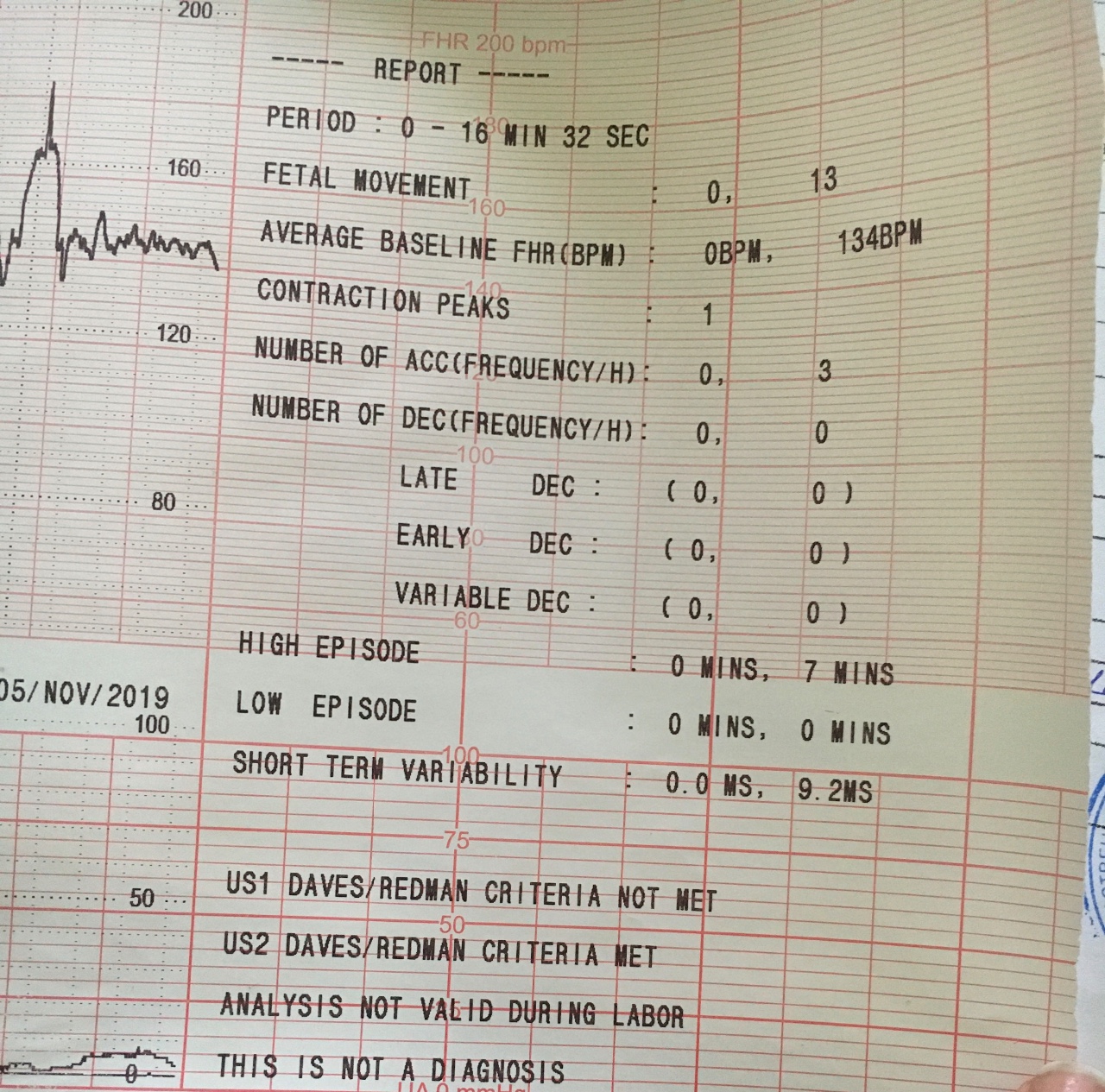 Ктг расшифровка. Fetal Movement КТГ норма. FHR КТГ расшифровка. Показатели КТГ при схватках в цифрах. КТГ смещение печати.