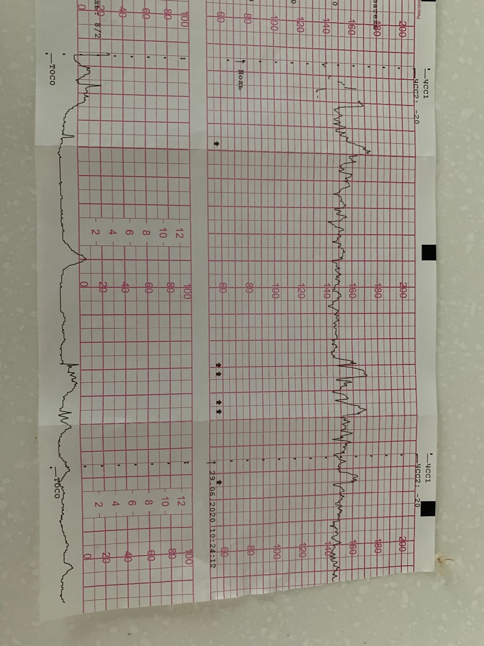 Ктг ребенка