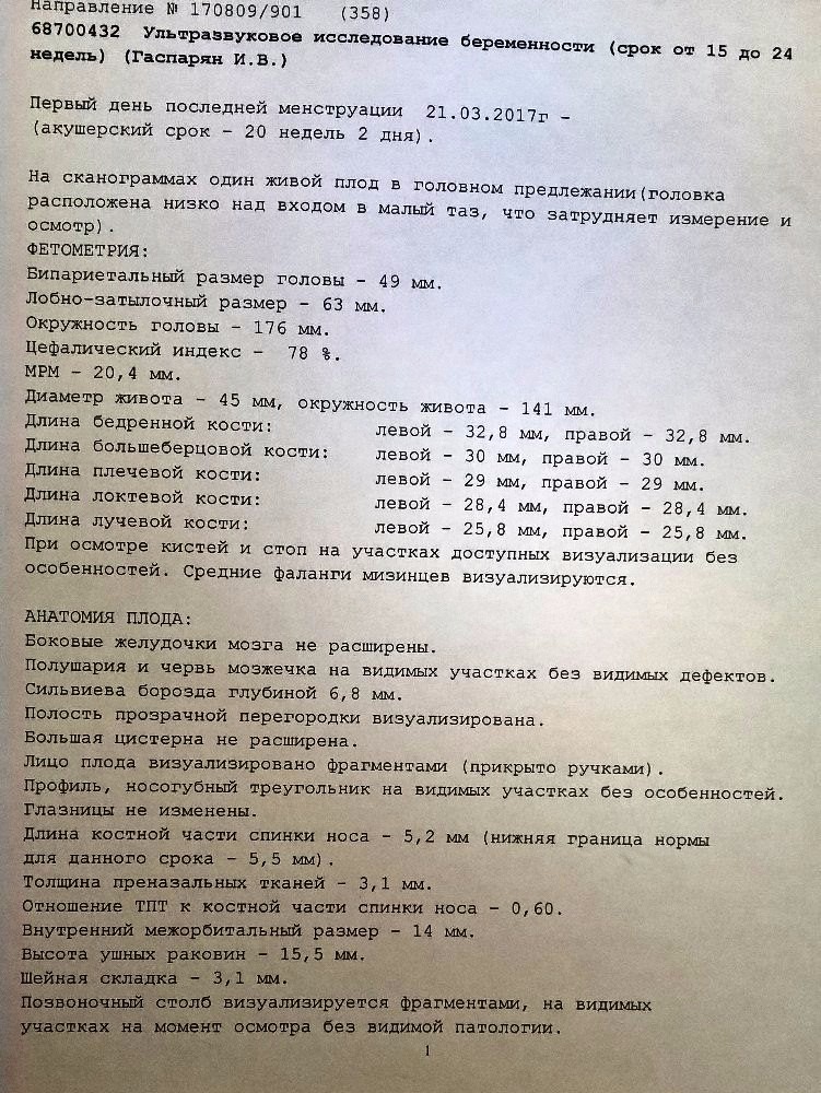 Длина костей. Норма носовой кости в 20 недель беременности УЗИ. Норма носовой кости. Кости носа норма. Норма носовой кости в 20.