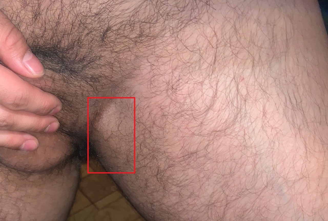 кожные заболевания у мужчин член фото 93