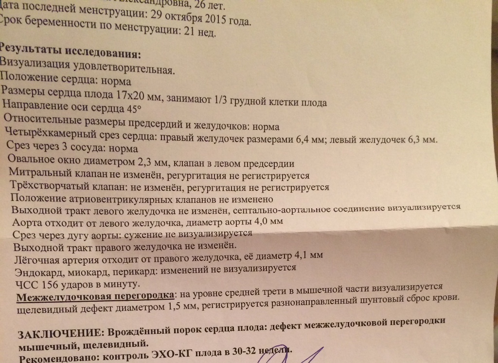 Эхо кг плода при беременности. УЗИ сердца плода. Сердце плода на УЗИ норма. УЗИ сердца плода нормы по неделям беременности. Сердцебиение плода по УЗИ.