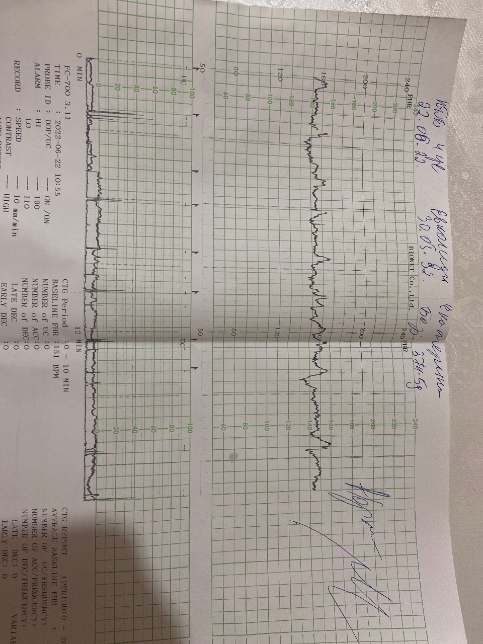 Ктг на 39 неделе беременности