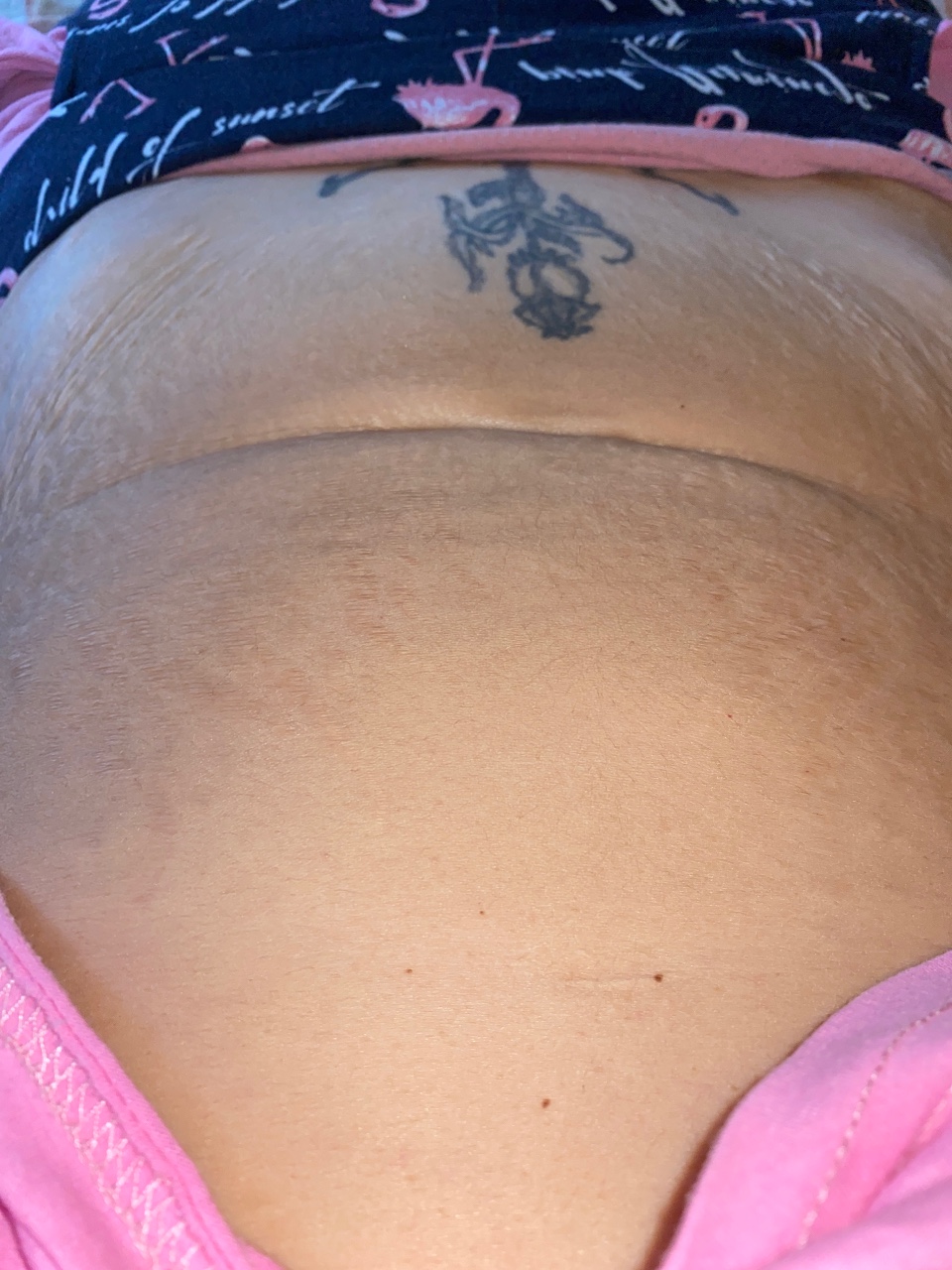 венозная сетка на груди на ранних сроках беременности фото 44