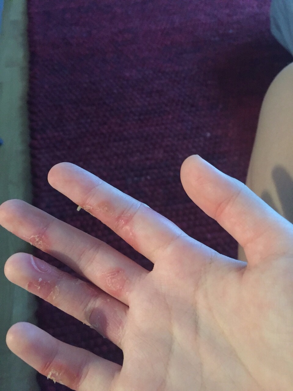 Пальцы после краски для волос