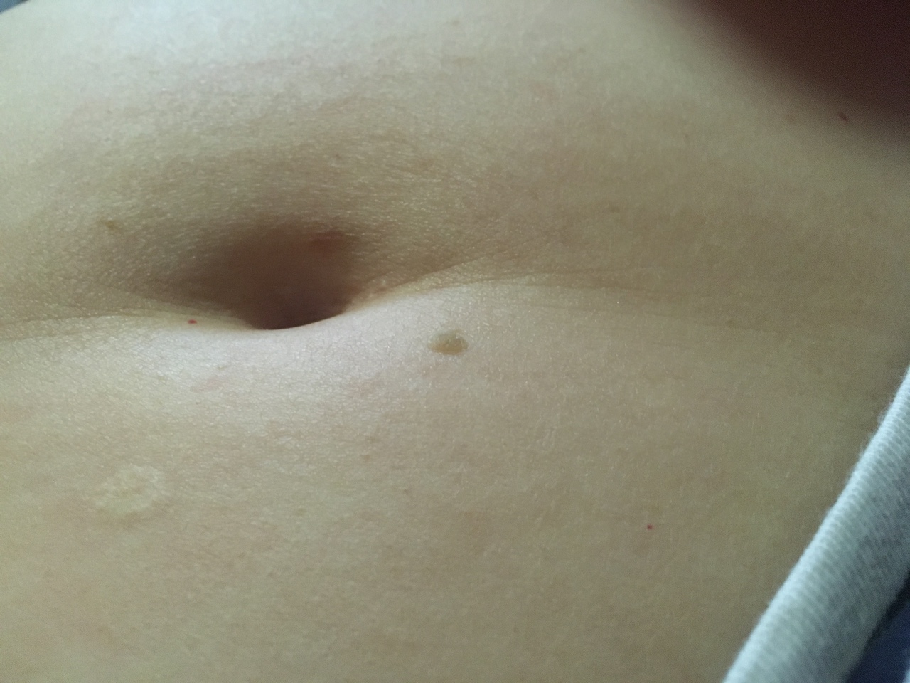 коричневые пятна на груди во время беременности фото 93
