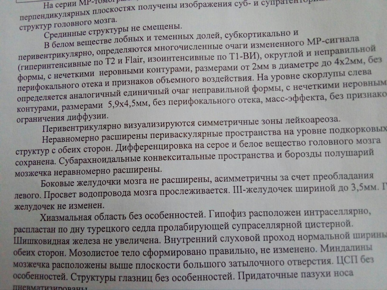 Субкортикальные очаги глиоза в белом веществе