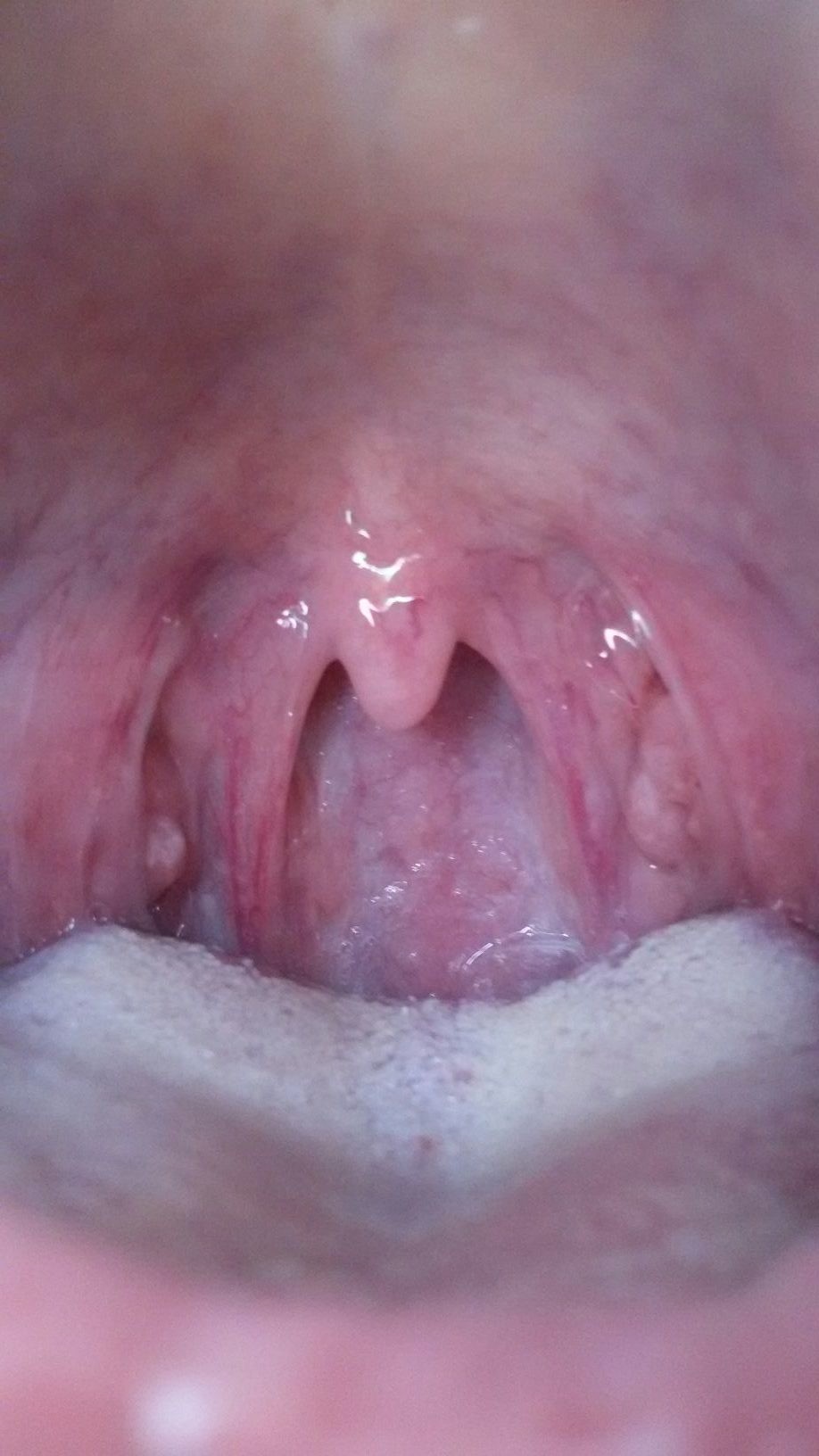 можно ли вылечить горло спермой фото 62