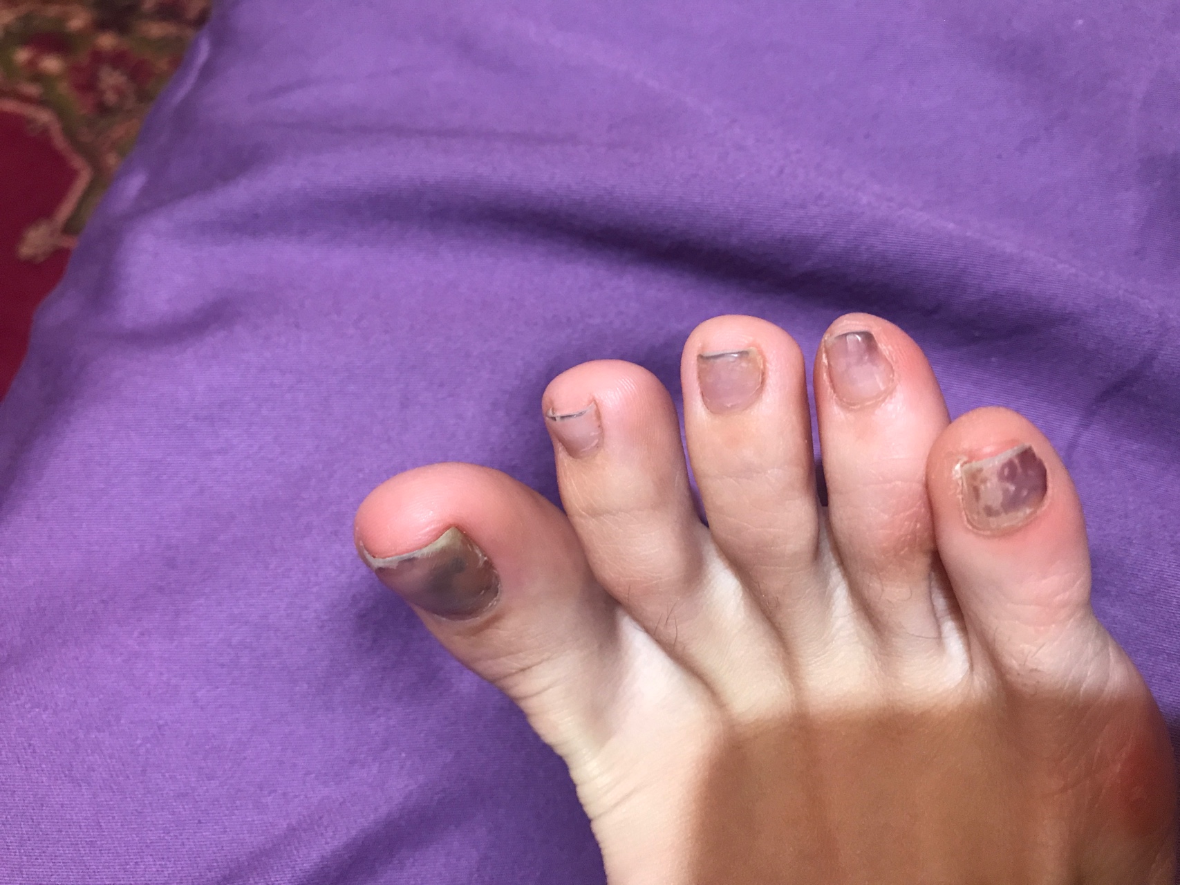 Ногти на ногах фиолетового оттенка
