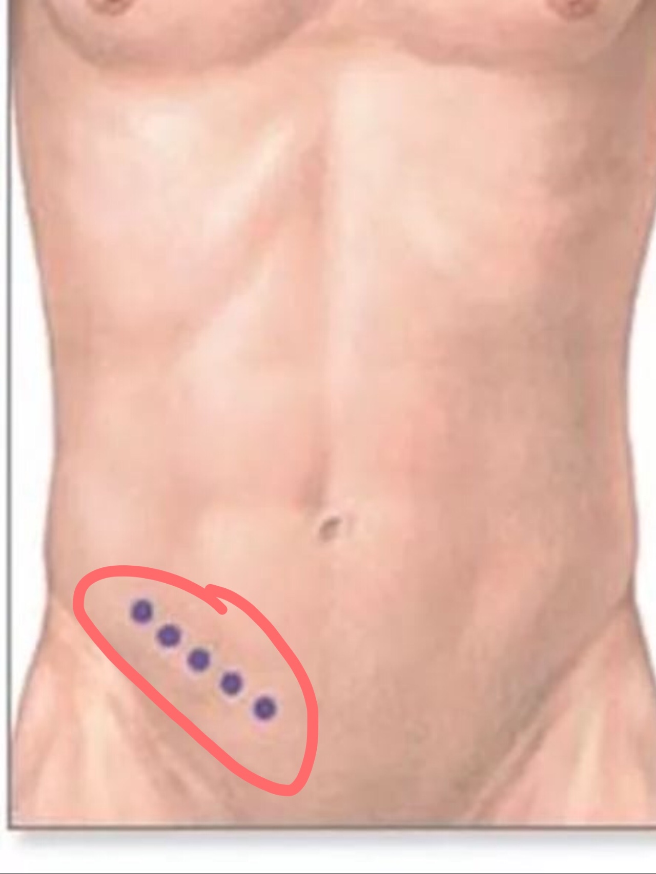 уплотнение под кожей на груди у мужчин фото 108