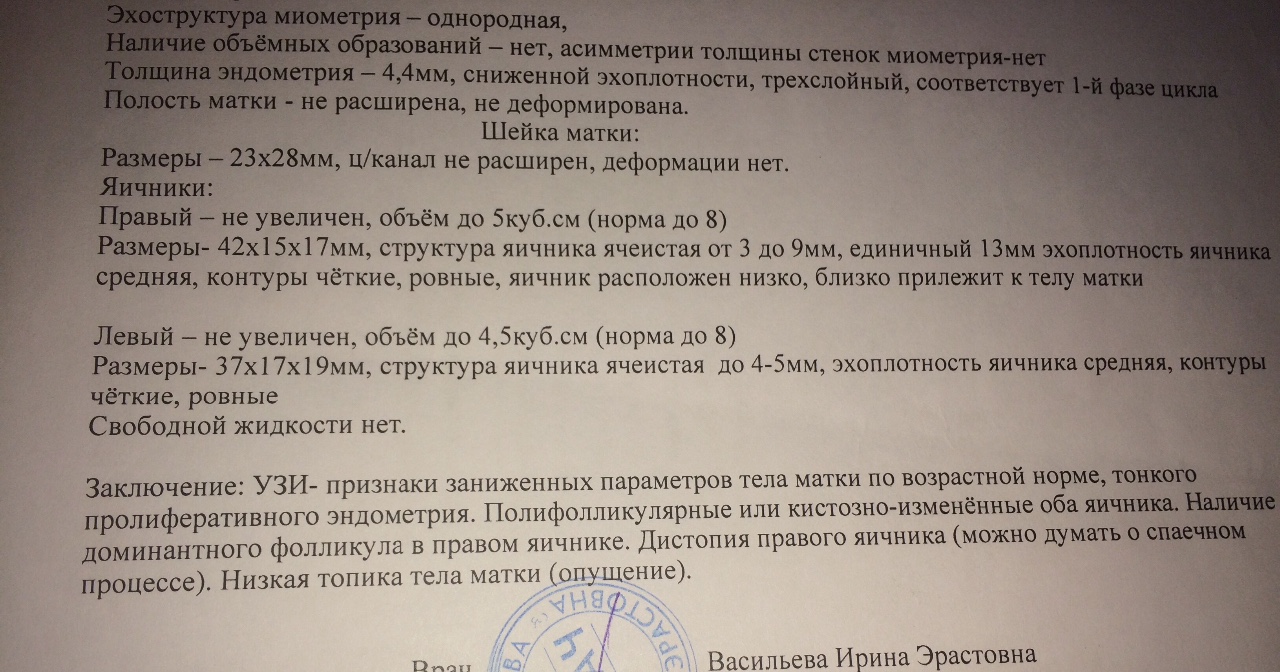 Миометрия что это такое у женщин. УЗИ при выпадении матки заключение. Эхоструктура миометрия.