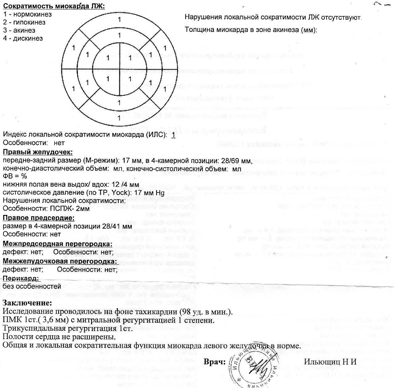 Индексы сократимости. Сократимость миокарда нормокинез. Нормокинез сердца что это. Индекс локальной сократимости миокарда. Нормокинез индекс локальной сократимости.