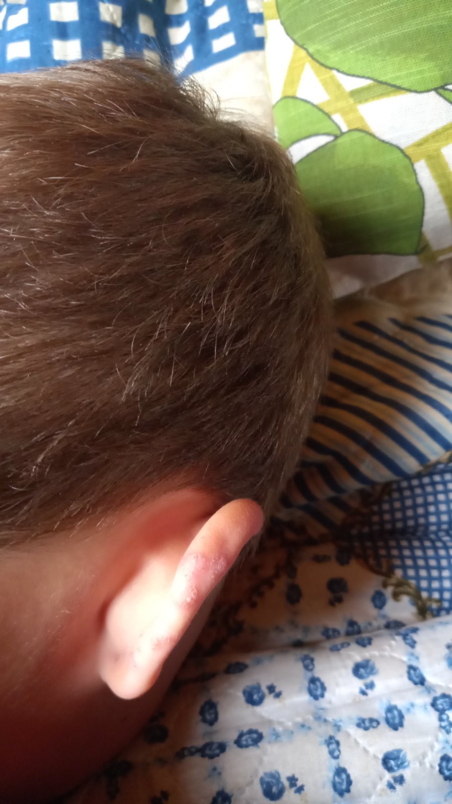 Скв у ребенка - Вопрос детскому ревматологу - 03 Онлайн