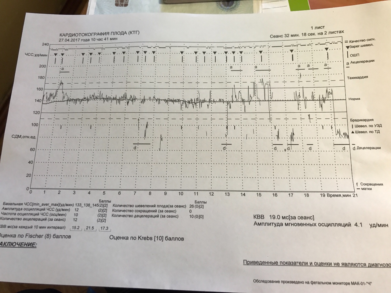 Ктг недели беременности. Результаты КТГ. График КТГ. Норма по КТГ. Кардиотокография плода расшифровка оценка.