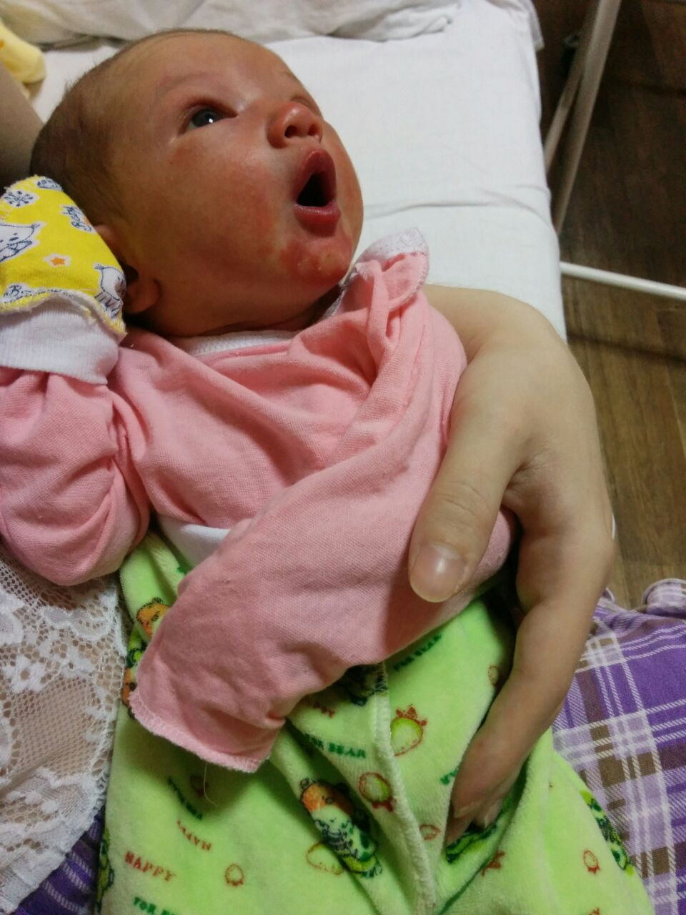 Проблемы со стулом у новорожденного на искусственном вскармливании до 1 месяца